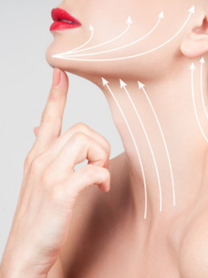 Neck Lift